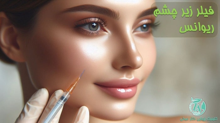 قیمت فیلر زیر چشم ریوانس