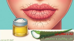 ترک لب و خشکی لب
