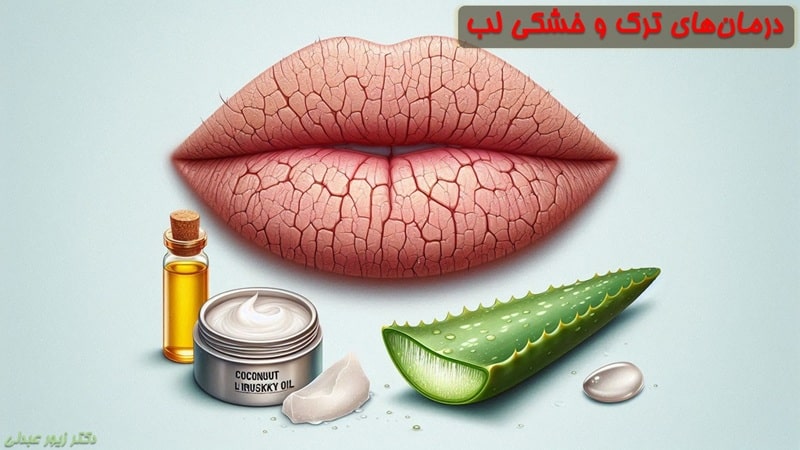 درمان ترک و خشکی لب