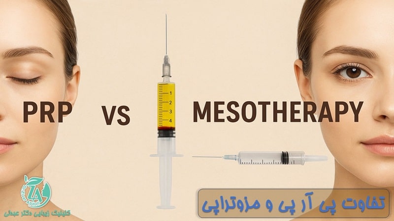 تفاوت پی آر پی و مزوتراپی